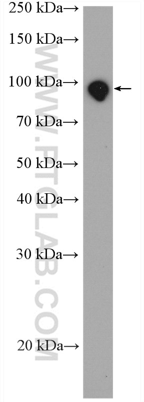 Western Blot (WB) analysis of mouse spleen tissue using PDE8A Polyclonal antibody (13956-1-AP)