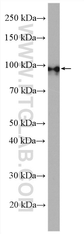 Western Blot (WB) analysis of SH-SY5Y cells using PDE8A Polyclonal antibody (13956-1-AP)
