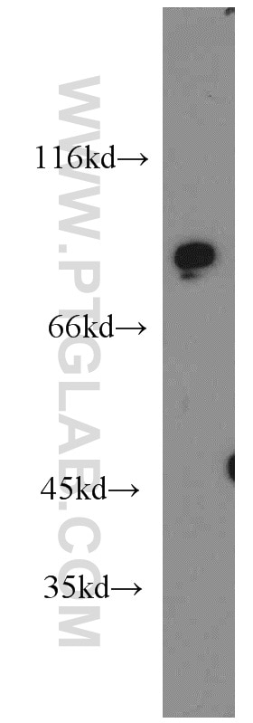 Western Blot (WB) analysis of mouse testis tissue using PDE8A Polyclonal antibody (13956-1-AP)