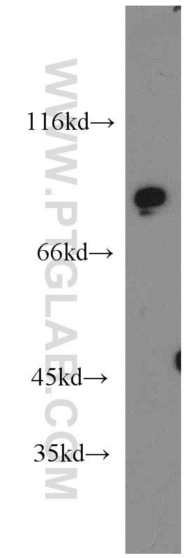 WB analysis of mouse testis using 13956-1-AP