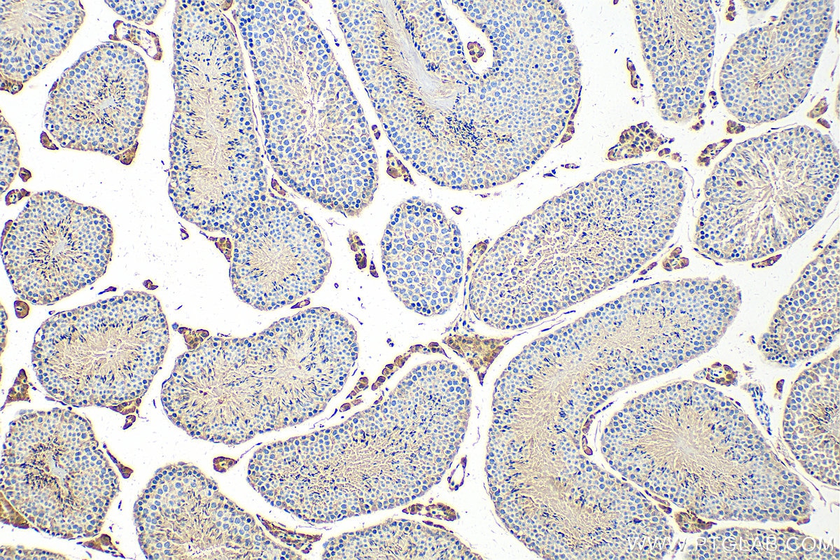 Immunohistochemistry (IHC) staining of mouse testis tissue using PDE8B Polyclonal antibody (30708-1-AP)
