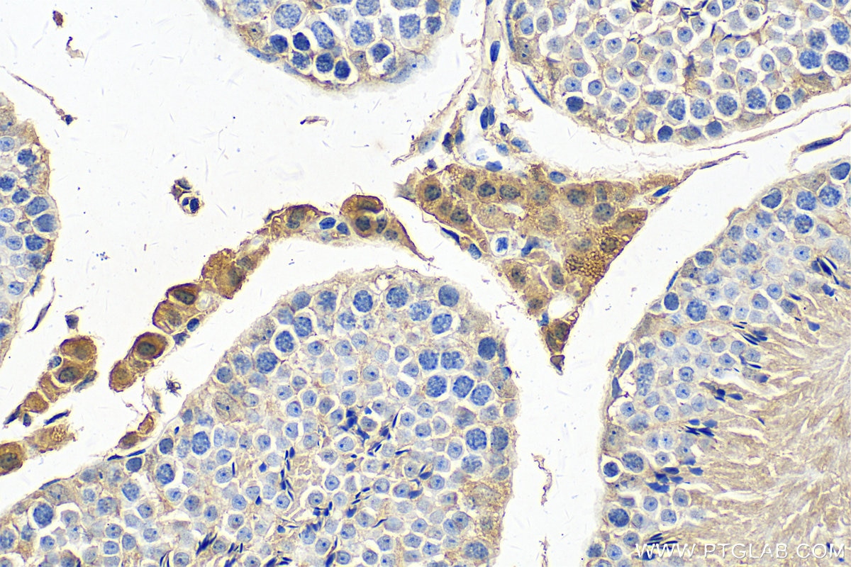 Immunohistochemistry (IHC) staining of mouse testis tissue using PDE8B Polyclonal antibody (30708-1-AP)