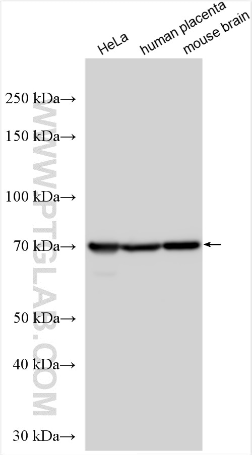 Western Blot (WB) analysis of various lysates using PDE8B Polyclonal antibody (30708-1-AP)
