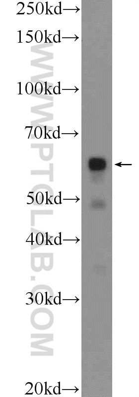 WB analysis of MCF-7 using 24842-1-AP