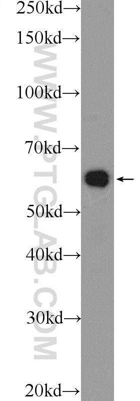 WB analysis of MDA-MB-453s using 24842-1-AP