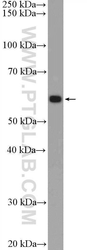 Western Blot (WB) analysis of MDA-MB-453s cells using PDF Polyclonal antibody (24842-1-AP)