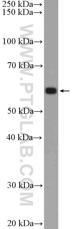 Western Blot (WB) analysis of MDA-MB-453s cells using PDF Polyclonal antibody (24842-1-AP)