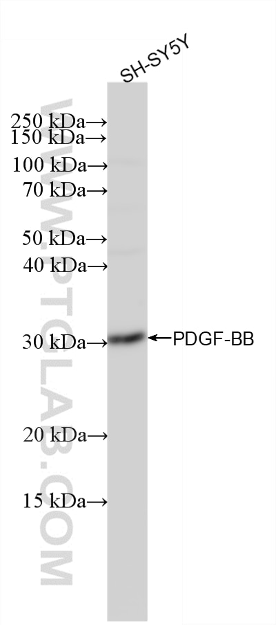 WB analysis of SH-SY5Y using 87506-1-RR Western Blot (WB) analysis of SH-SY5Y cells using PDGF-BB Recombinant monoclonal antibody (87506-1-RR)