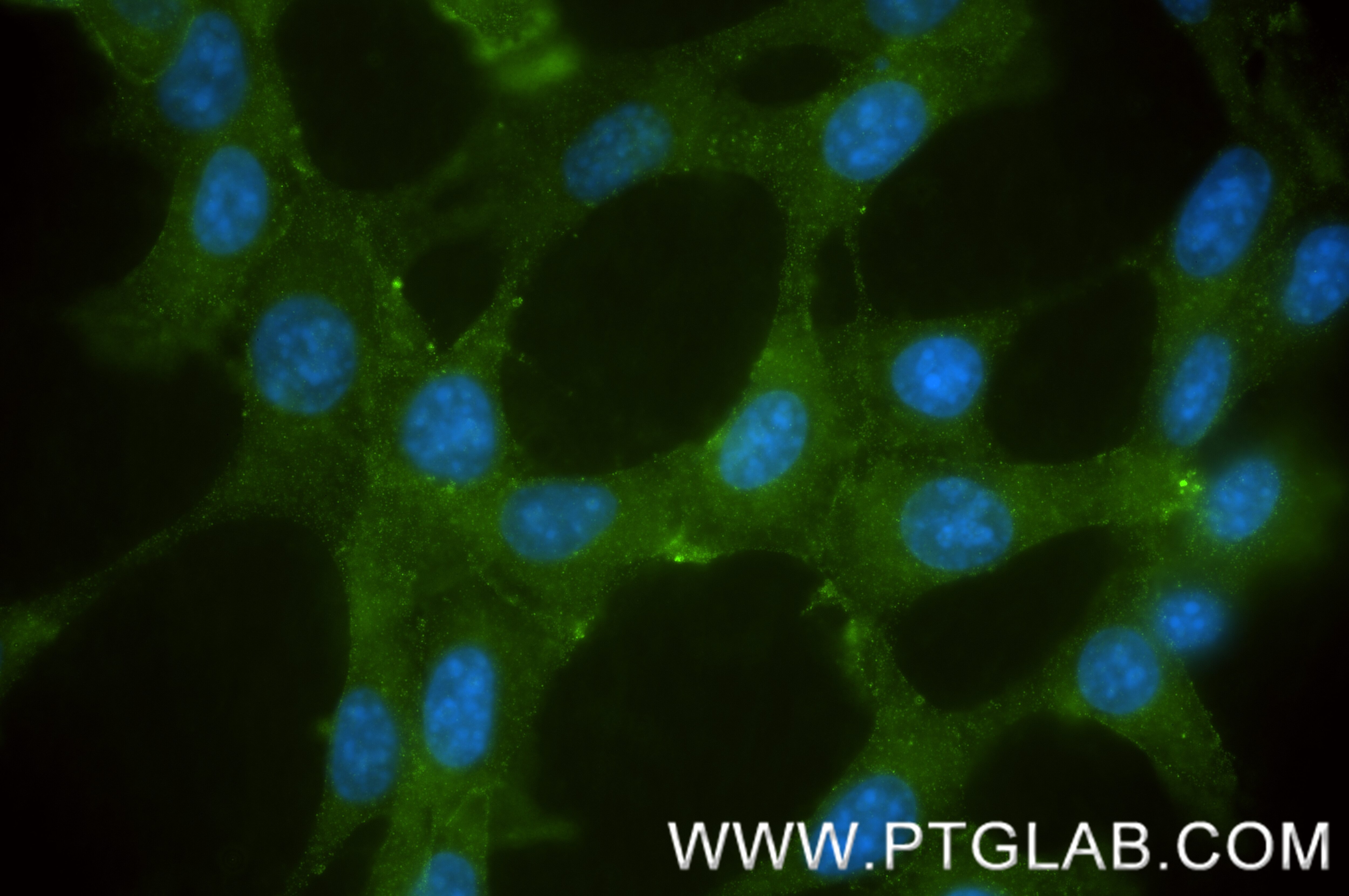Immunofluorescent analysis of (-20°C Methanol) fixed NIH/3T3 cells using PDGFR beta/CD140b antibody (84388-5-RR, Clone: 241754A6 ) at dilution of 1:200 and CoraLite®488-Conjugated Goat Anti-Rabbit IgG(H+L) (SA00013-2). Immunofluorescence (IF) / fluorescent staining of NIH/3T3 cells using PDGFR beta/CD140b Recombinant antibody (84388-5-RR)
