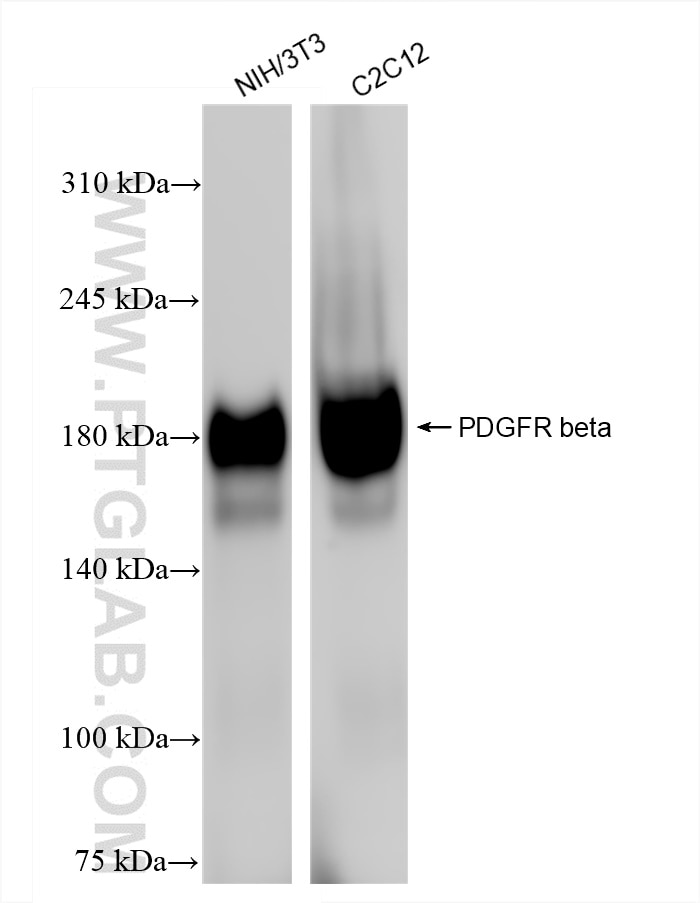 Western Blot (WB) analysis of various lysates using PDGF R beta Recombinant antibody (84388-5-RR)