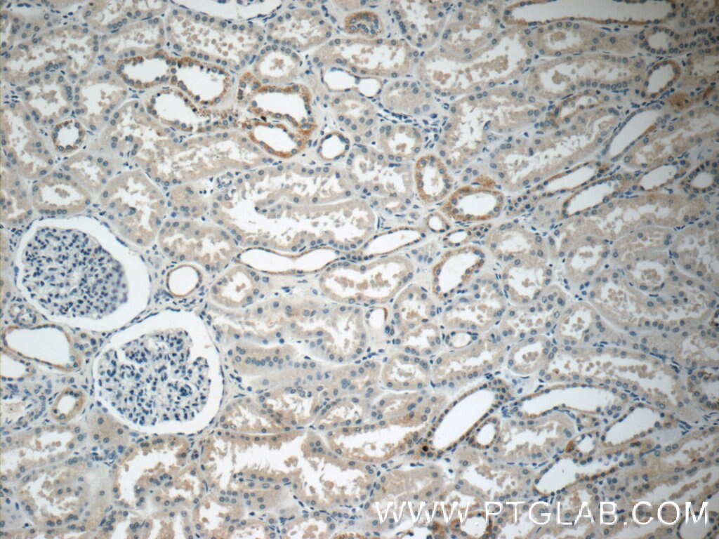 Immunohistochemistry (IHC) staining of human kidney tissue using PDGFB Polyclonal antibody (13239-1-AP)