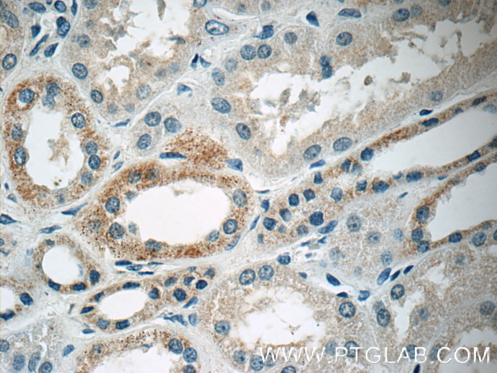 Immunohistochemistry (IHC) staining of human kidney tissue using PDGFB Polyclonal antibody (13239-1-AP)