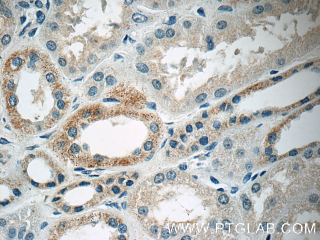 Immunohistochemistry (IHC) staining of human kidney tissue using PDGFB Polyclonal antibody (13239-1-AP)