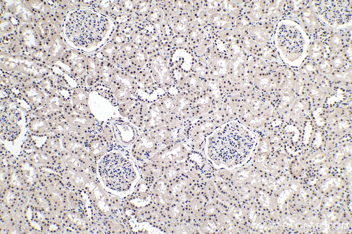 Immunohistochemistry (IHC) staining of human kidney tissue using PDGFC Polyclonal antibody (55076-1-AP)