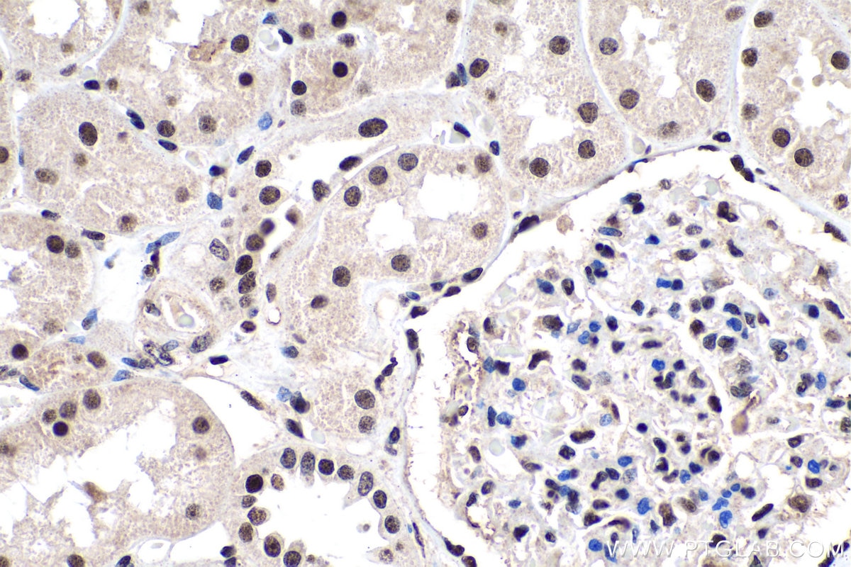 Immunohistochemistry (IHC) staining of human kidney tissue using PDGFC Polyclonal antibody (55076-1-AP)