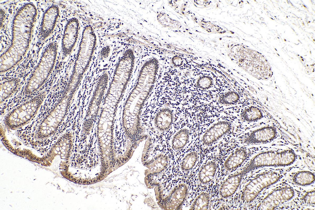 Immunohistochemistry (IHC) staining of human colon tissue using PDGFC Polyclonal antibody (55076-1-AP)