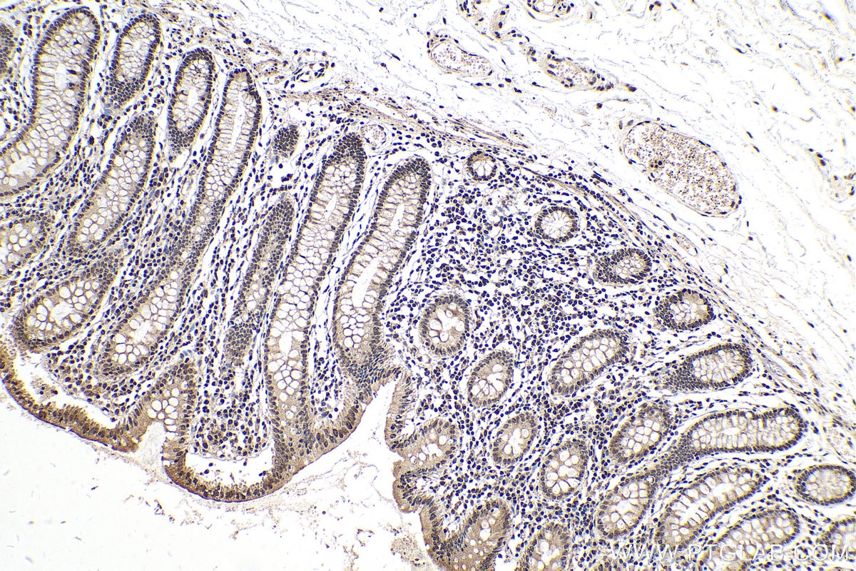 IHC staining of human colon using 55076-1-AP