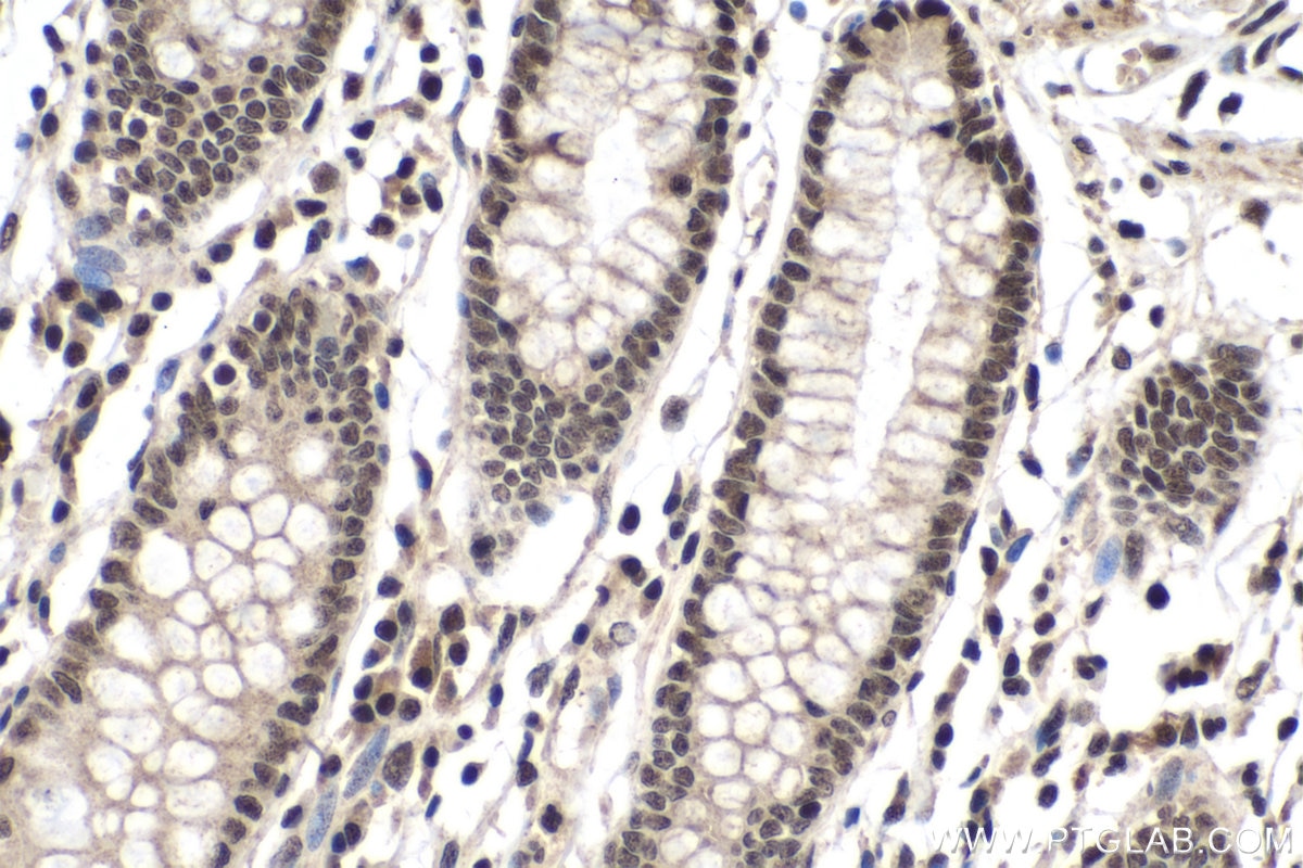 Immunohistochemistry (IHC) staining of human colon tissue using PDGFC Polyclonal antibody (55076-1-AP)