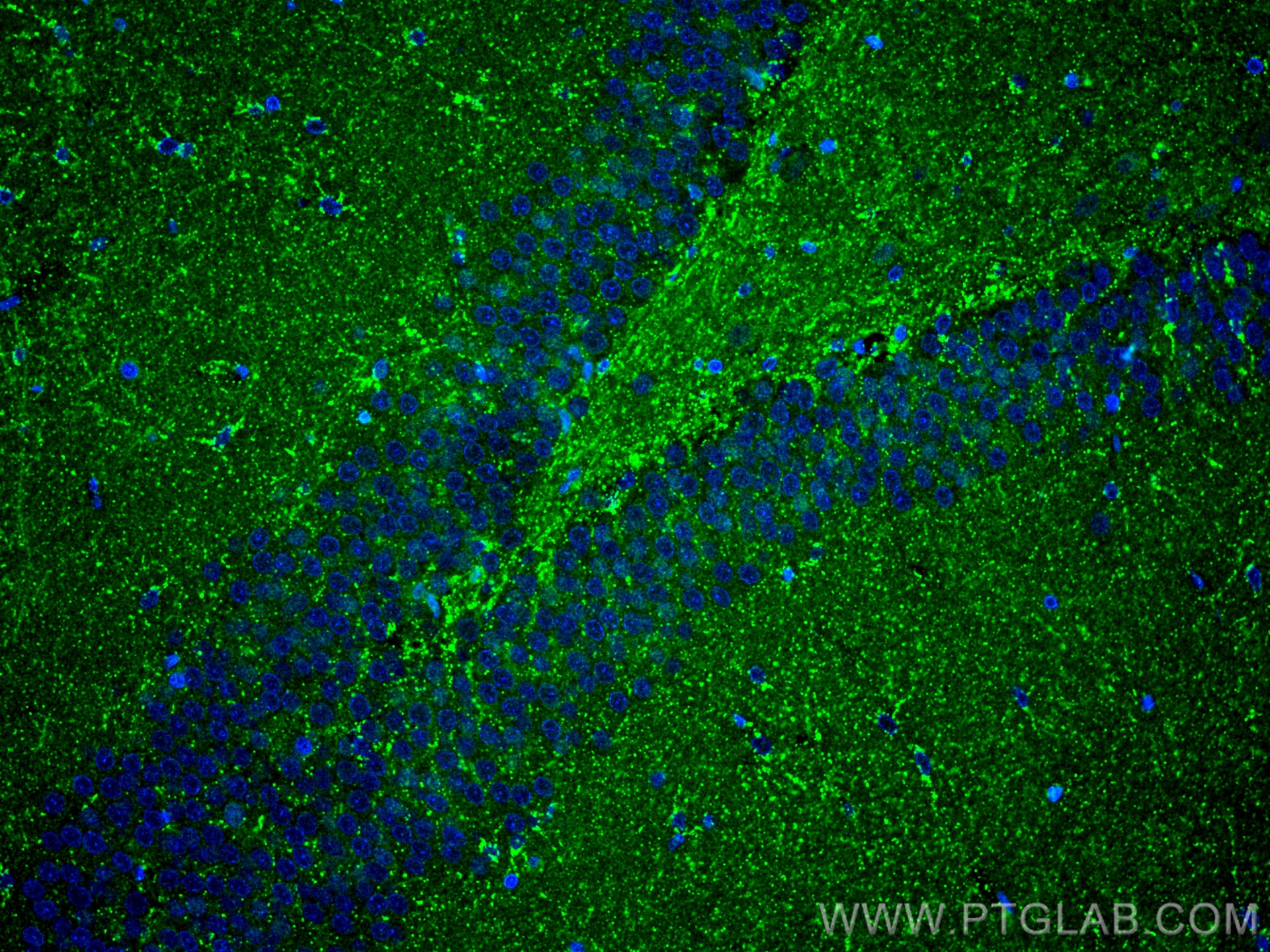 Immunofluorescence (IF) / fluorescent staining of rat brain tissue using PDGFD Polyclonal antibody (14075-1-AP)