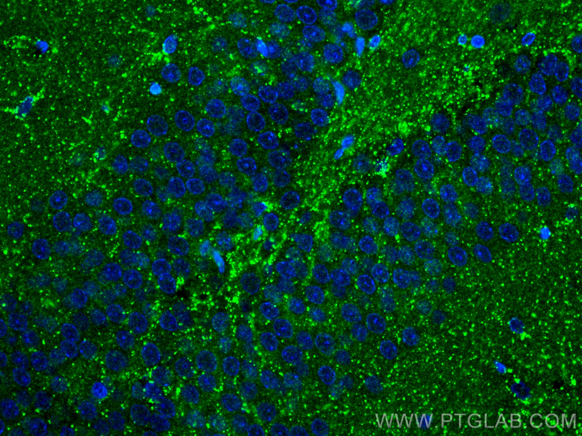 Immunofluorescence (IF) / fluorescent staining of rat brain tissue using PDGFD Polyclonal antibody (14075-1-AP)