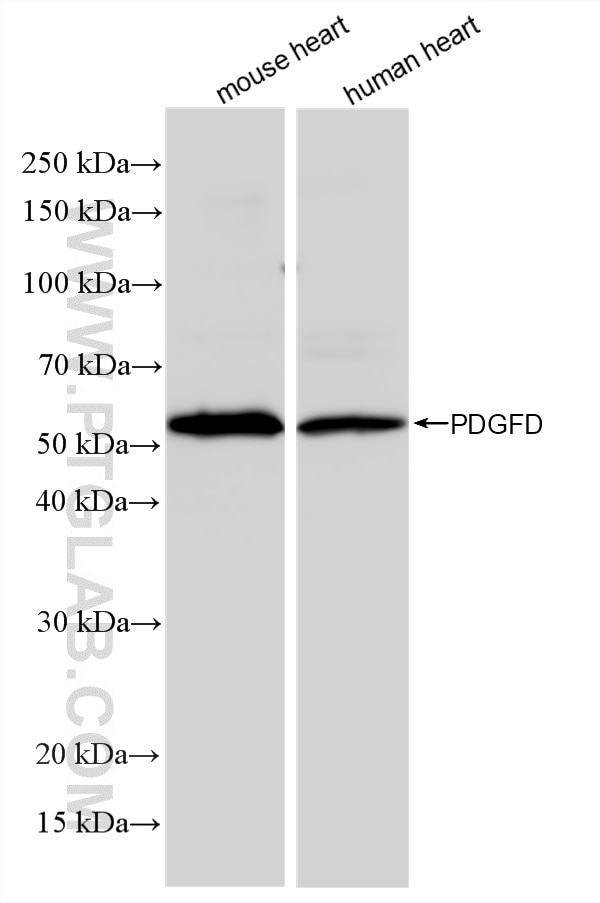 WB analysis using 81718-2-RR (same clone as 81718-2-PBS) Western Blot (WB) analysis of various lysates using PDGF-D Recombinant monoclonal antibody (81718-2-RR)