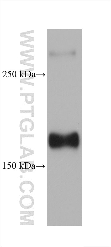 WB analysis of U2OS using 60535-13-Ig Western Blot (WB) analysis of U2OS cells using PDGFR beta/CD140b Monoclonal antibody (60535-13-Ig)