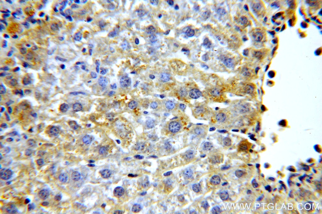 Immunohistochemistry (IHC) staining of mouse liver tissue using PDGFR alpha Polyclonal antibody (10945-1-AP)