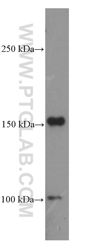 Western Blot (WB) analysis of HT-1080 cells using PDGFR alpha Monoclonal antibody (60045-1-Ig)