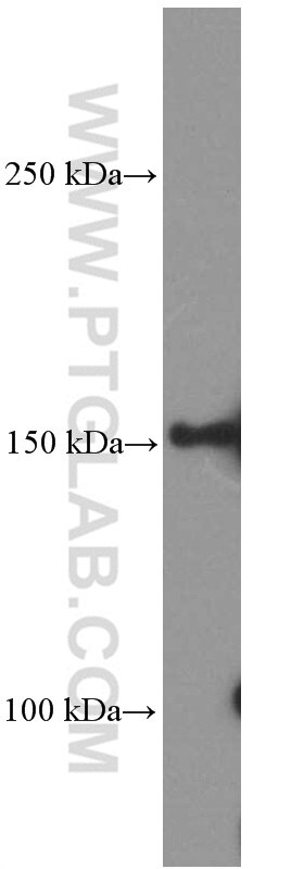 Western Blot (WB) analysis of U-251 cells using PDGFR alpha Monoclonal antibody (60045-1-Ig)