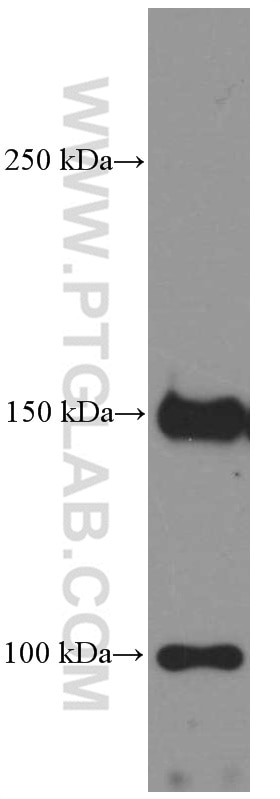 Western Blot (WB) analysis of HUVEC cells using PDGFR alpha Monoclonal antibody (60045-1-Ig)