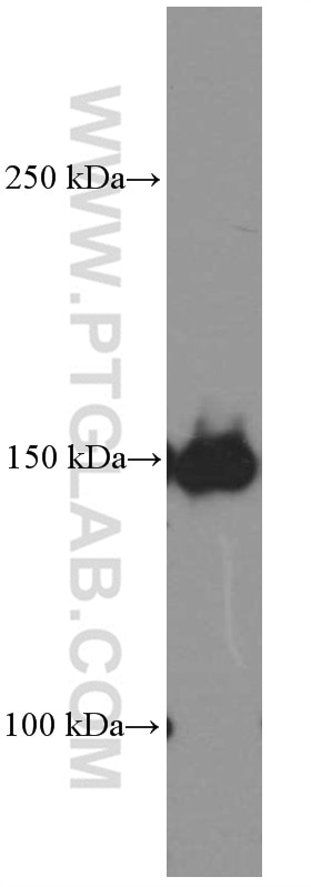 Western Blot (WB) analysis of THP-1 cells using PDGFR alpha Monoclonal antibody (60045-1-Ig)