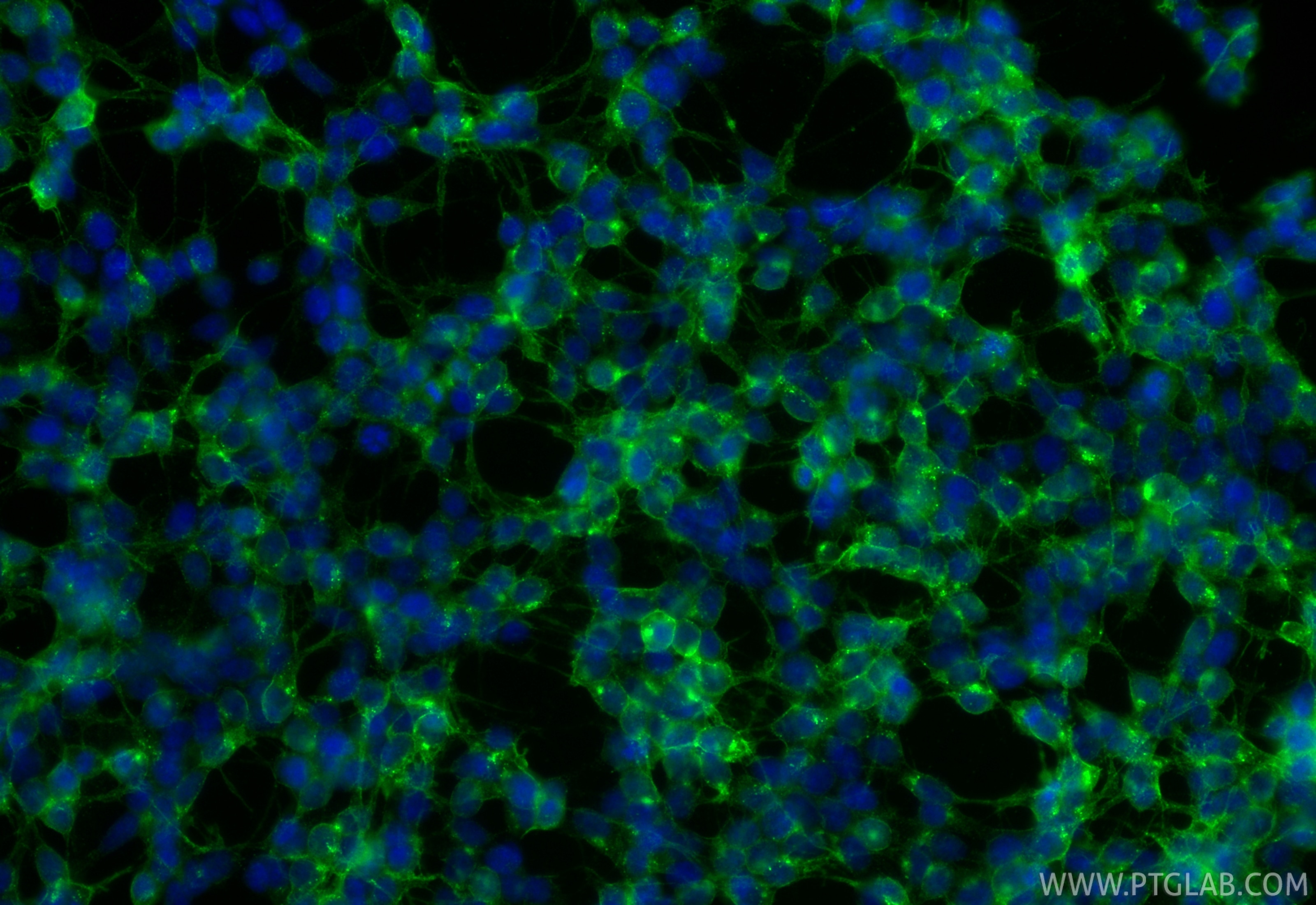 IF Staining of SH-SY5Y using 84383-2-RR Immunofluorescence (IF) / fluorescent staining of SH-SY5Y cells using PDGFR alpha/CD140a Recombinant monoclonal antibody (84383-2-RR)