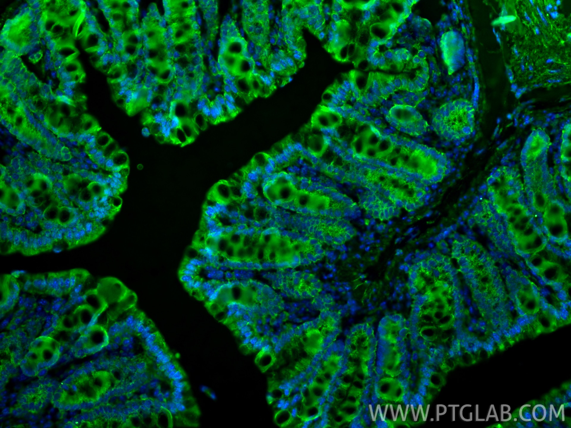 Immunofluorescence (IF) / fluorescent staining of mouse colon tissue using PDGFR beta/CD140b Polyclonal antibody (13449-1-AP)