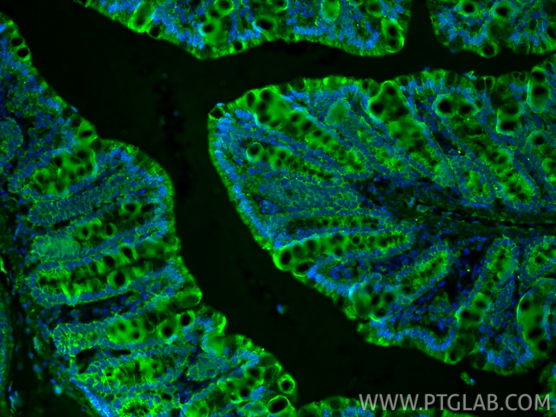 Immunofluorescence (IF) / fluorescent staining of mouse colon tissue using PDGFR beta/CD140b Polyclonal antibody (13449-1-AP)