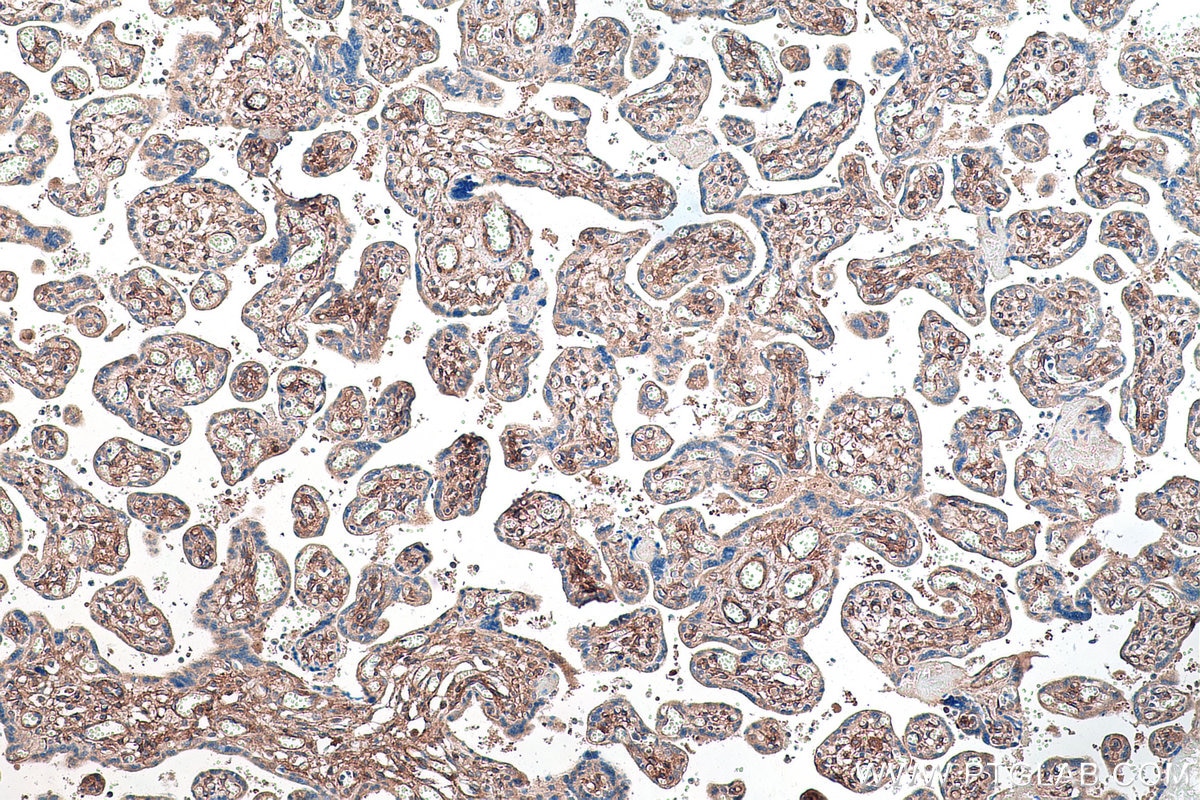 Immunohistochemistry (IHC) staining of human placenta tissue using PDGFR beta Polyclonal antibody (13449-1-AP)