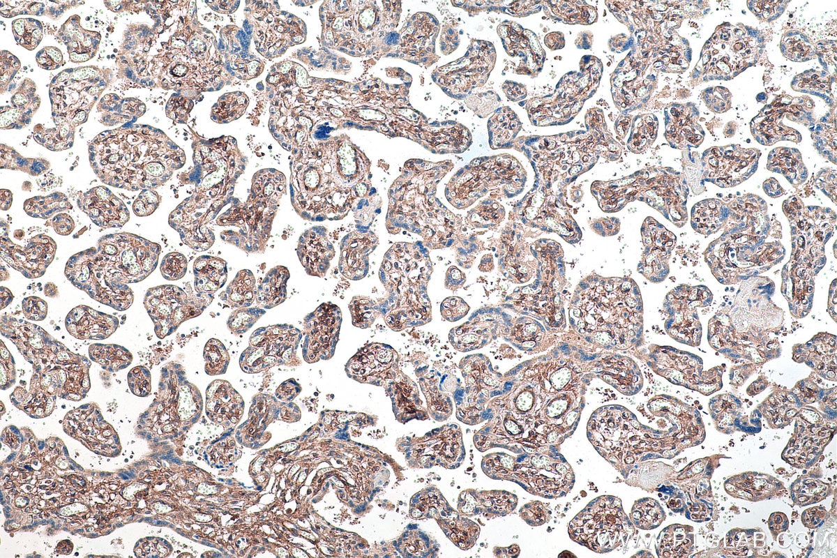 IHC staining of human placenta using 13449-1-AP