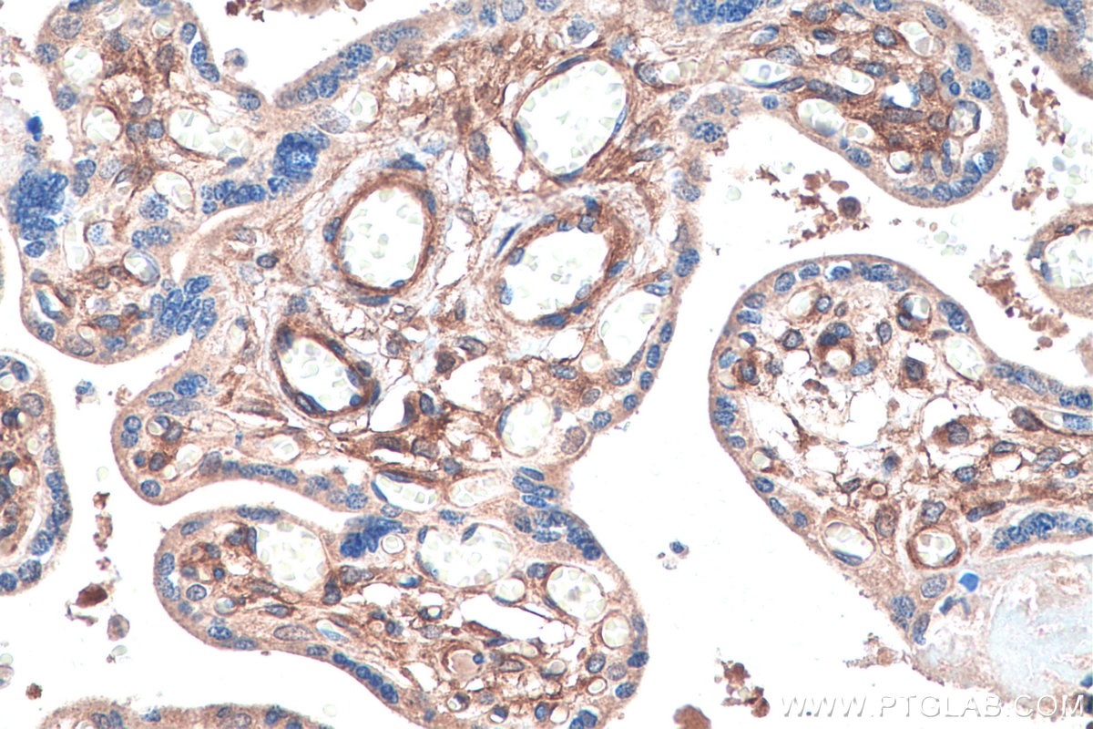 Immunohistochemistry (IHC) staining of human placenta tissue using PDGFR beta Polyclonal antibody (13449-1-AP)