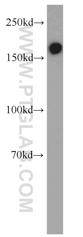 WB analysis of mouse lung using 13449-1-AP