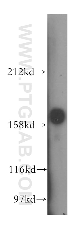 Western Blot (WB) analysis of mouse lung tissue using PDGFR beta Polyclonal antibody (13449-1-AP)