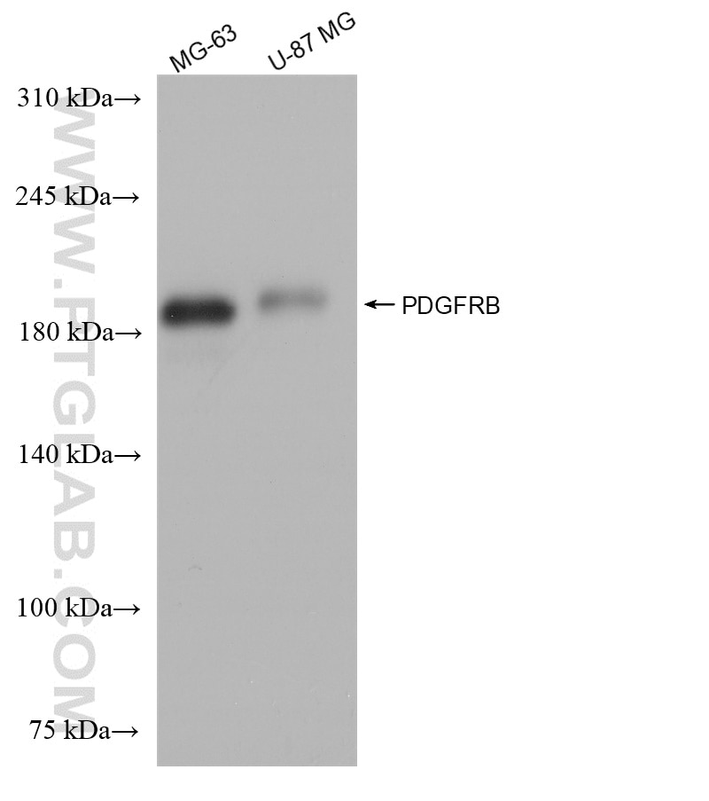 WB analysis using 82943-1-RR