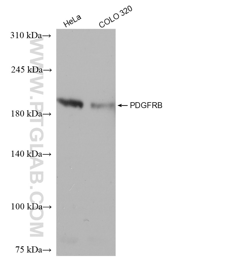 WB analysis using 82943-1-RR