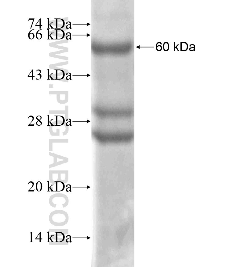 PDGFRB fusion protein Ag17561 SDS-PAGE