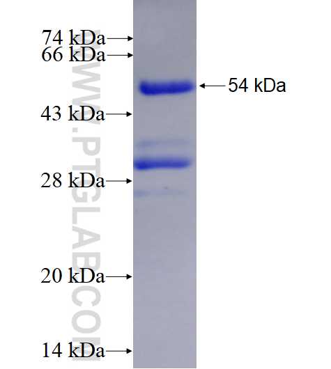 PDGFRB fusion protein Ag4285 SDS-PAGE