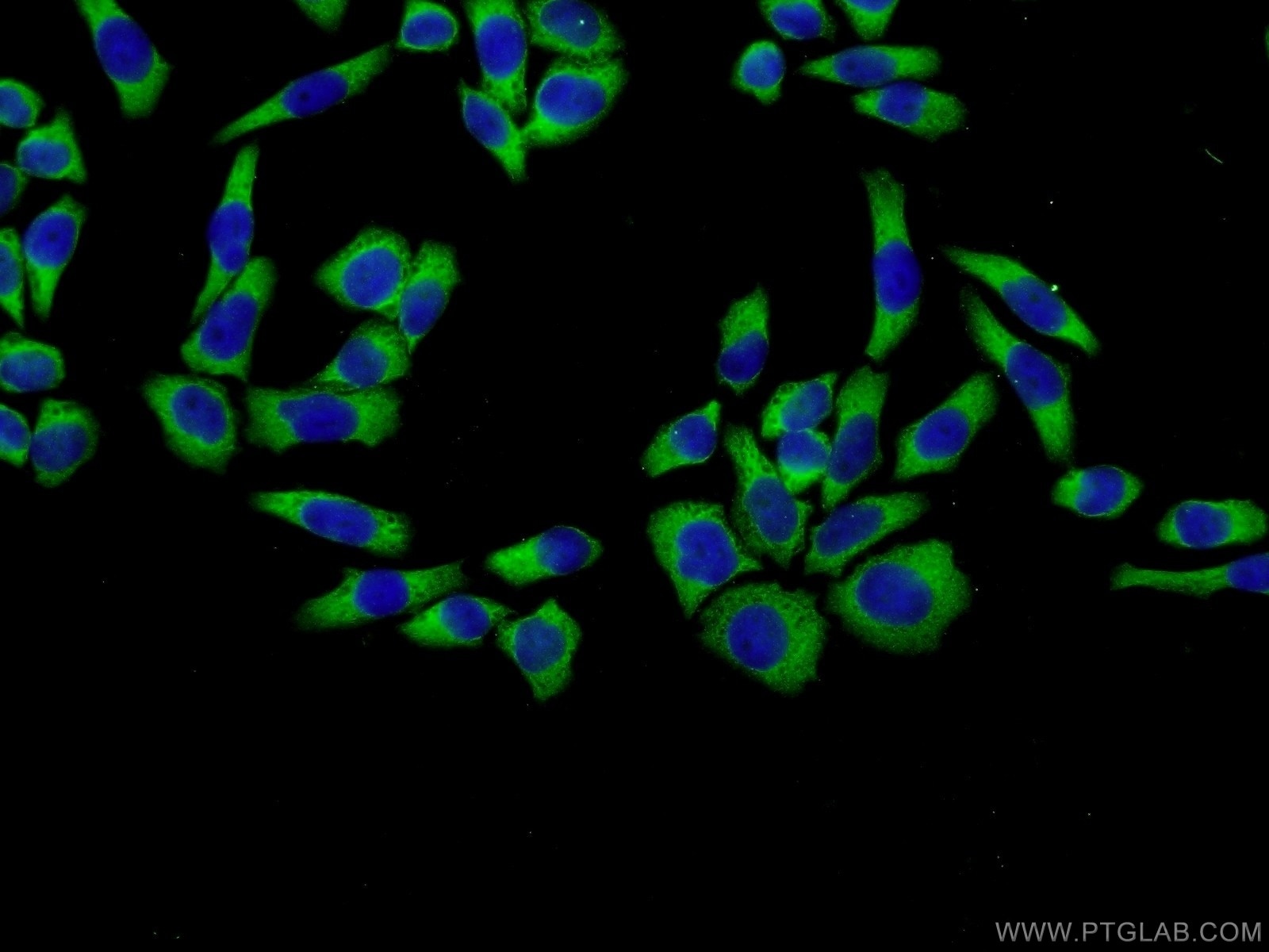 Immunofluorescence (IF) / fluorescent staining of L02 cells using PDGFRL Polyclonal antibody (16217-1-AP)