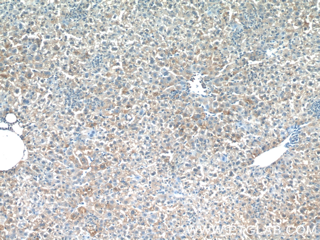 Immunohistochemistry (IHC) staining of mouse liver tissue using PDGFRL Polyclonal antibody (16217-1-AP)
