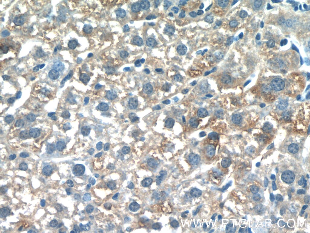 Immunohistochemistry (IHC) staining of mouse liver tissue using PDGFRL Polyclonal antibody (16217-1-AP)