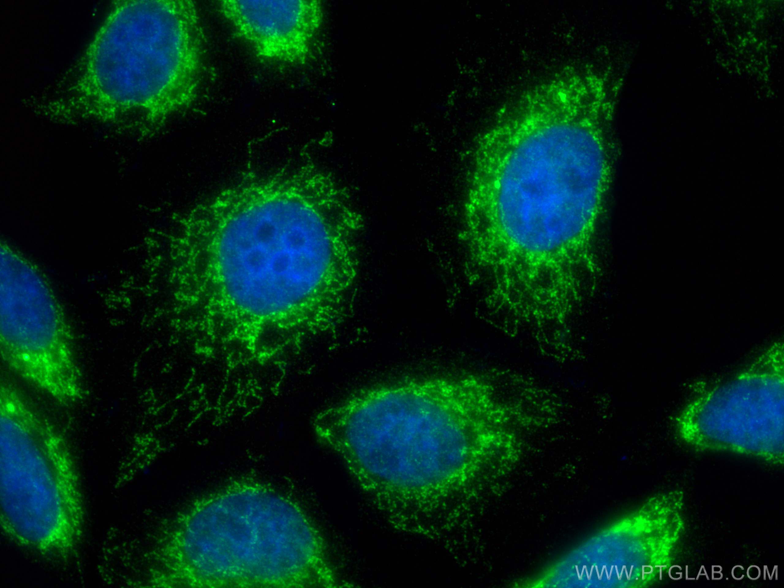 Immunofluorescence (IF) / fluorescent staining of HepG2 cells using PDH E1 Alpha Polyclonal antibody (18068-1-AP)
