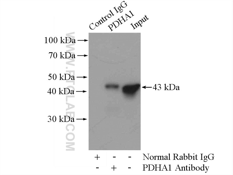 Immunoprecipitation (IP) experiment of mouse kidney tissue using PDH E1 Alpha Polyclonal antibody (18068-1-AP)