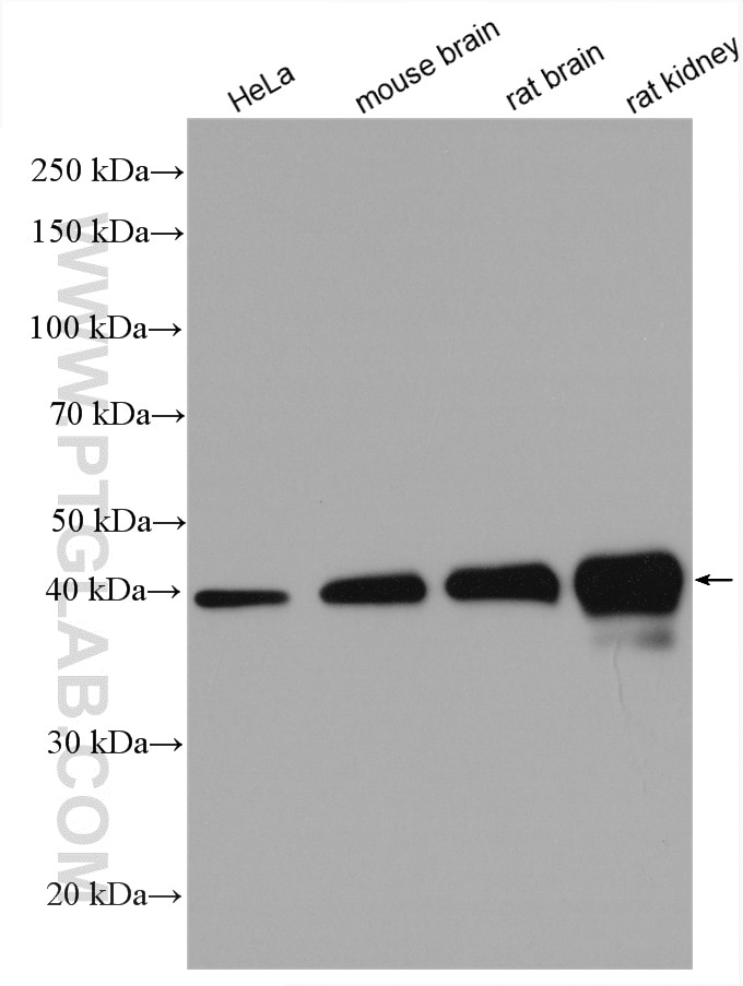 Western Blot (WB) analysis of various lysates using PDH E1 Alpha Polyclonal antibody (18068-1-AP)