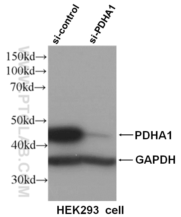 Western Blot (WB) analysis of HEK293 cells using PDH E1 Alpha Polyclonal antibody (18068-1-AP)